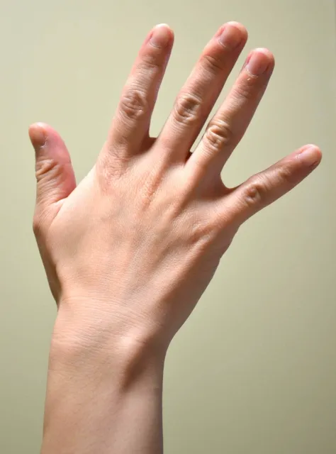 手の血管が浮き出る原因は？【女性】